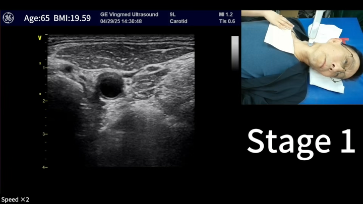 Ultrasound robot preview